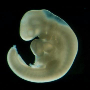 embryo-at-4-weeks.jpg